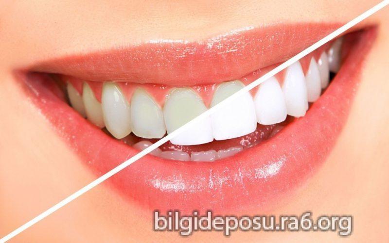 Altı Adımda Diş Temizliği Nasıl Yapılır?